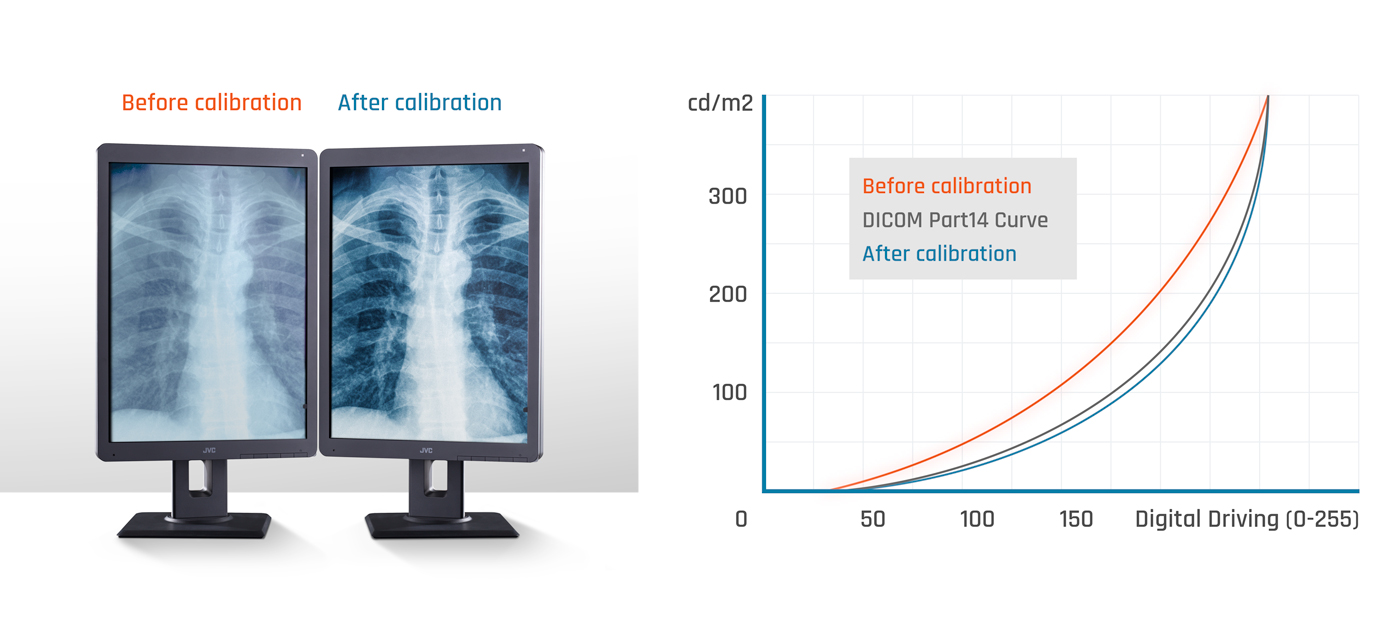 jvc-double-dicom-technology